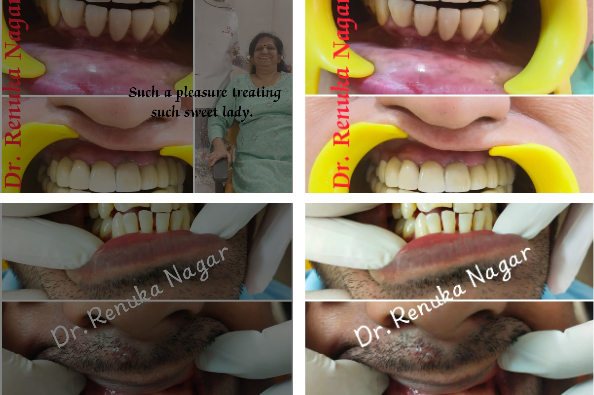 Best Dental Treatment in Hauz Khas