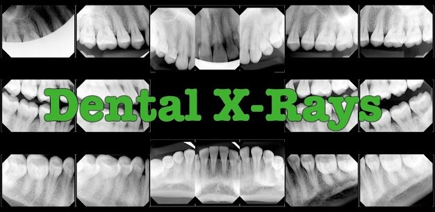 Best Dental Clinic in Saket, South Delhi