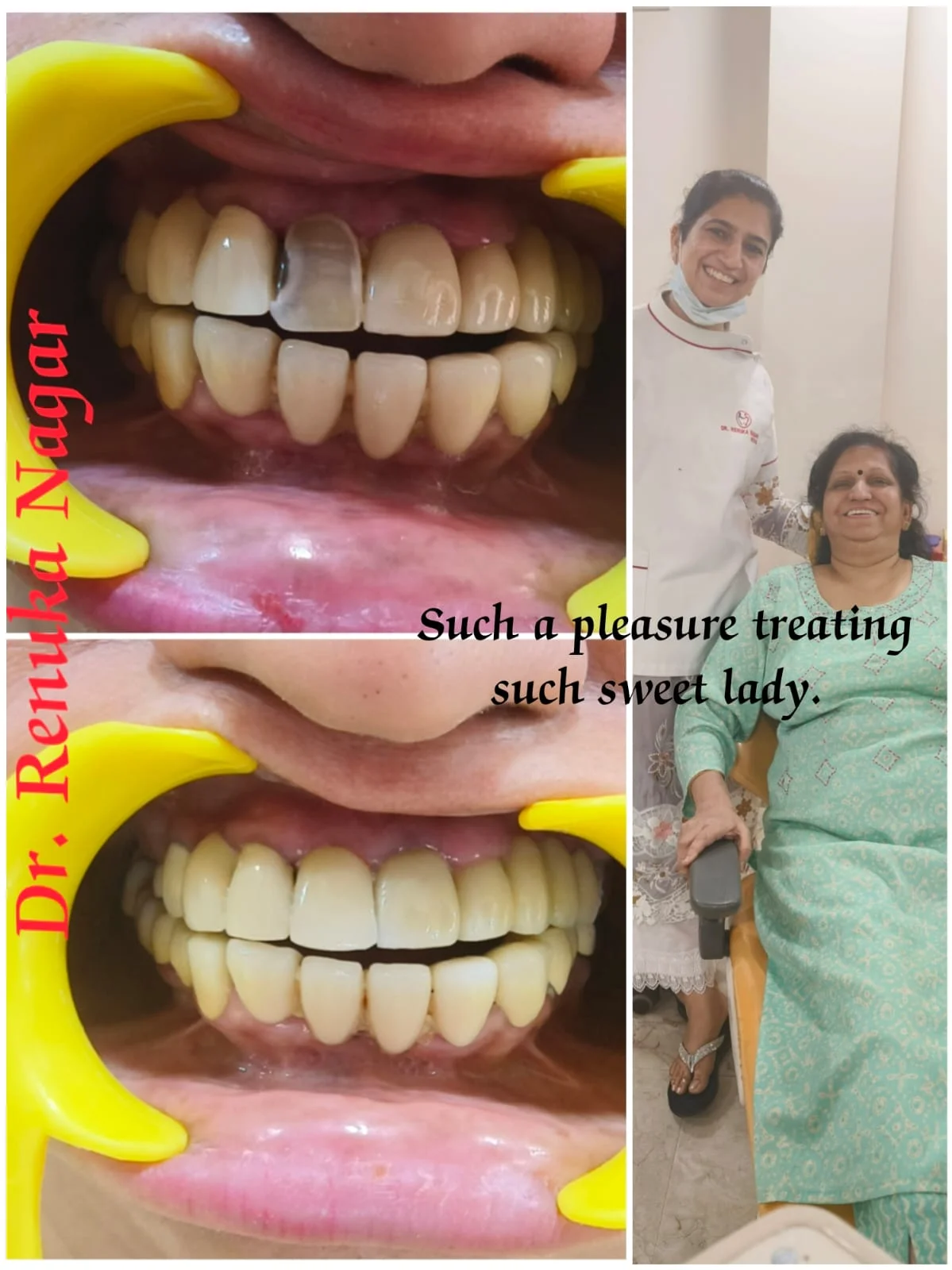 Best Dental Treatments Clinic in Saket, South Delhi