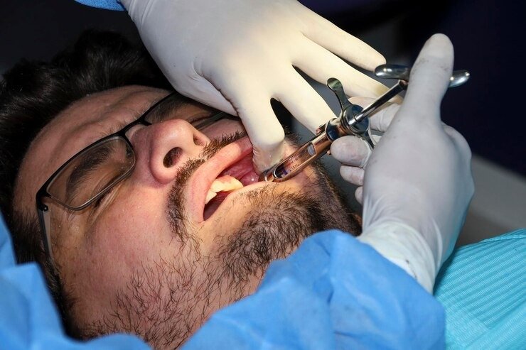 Best Oral Surgeon in South Delhi