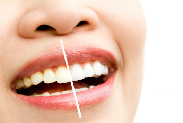 Best Dental Clinic in Malviya Nagar