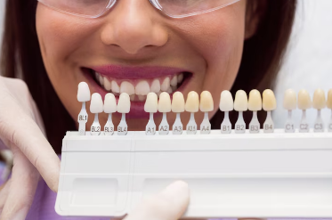 Best Cosmetic Tooth Coloured Filling Treatement in New Delhi
