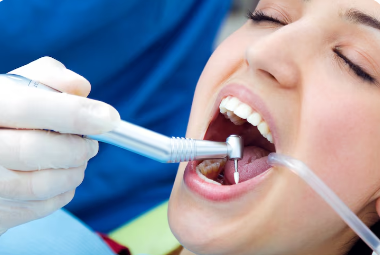 Best Teeth Cleaning & Polishing in Saket