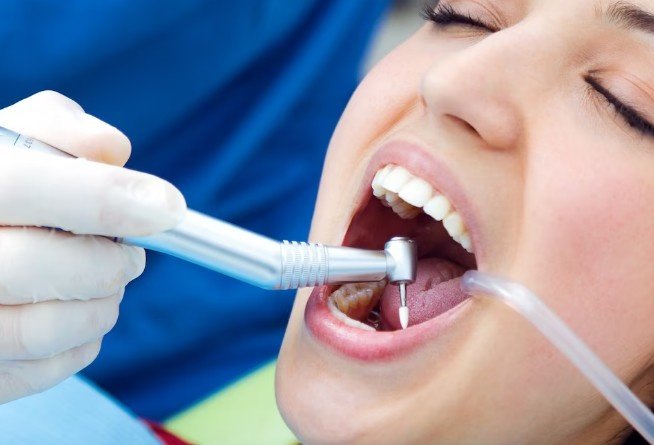 Root Canal Treatment in Saket