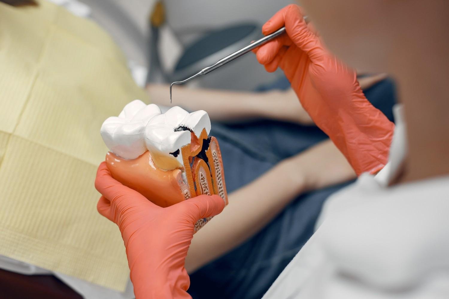 Best Root Canal Treatment in Saket