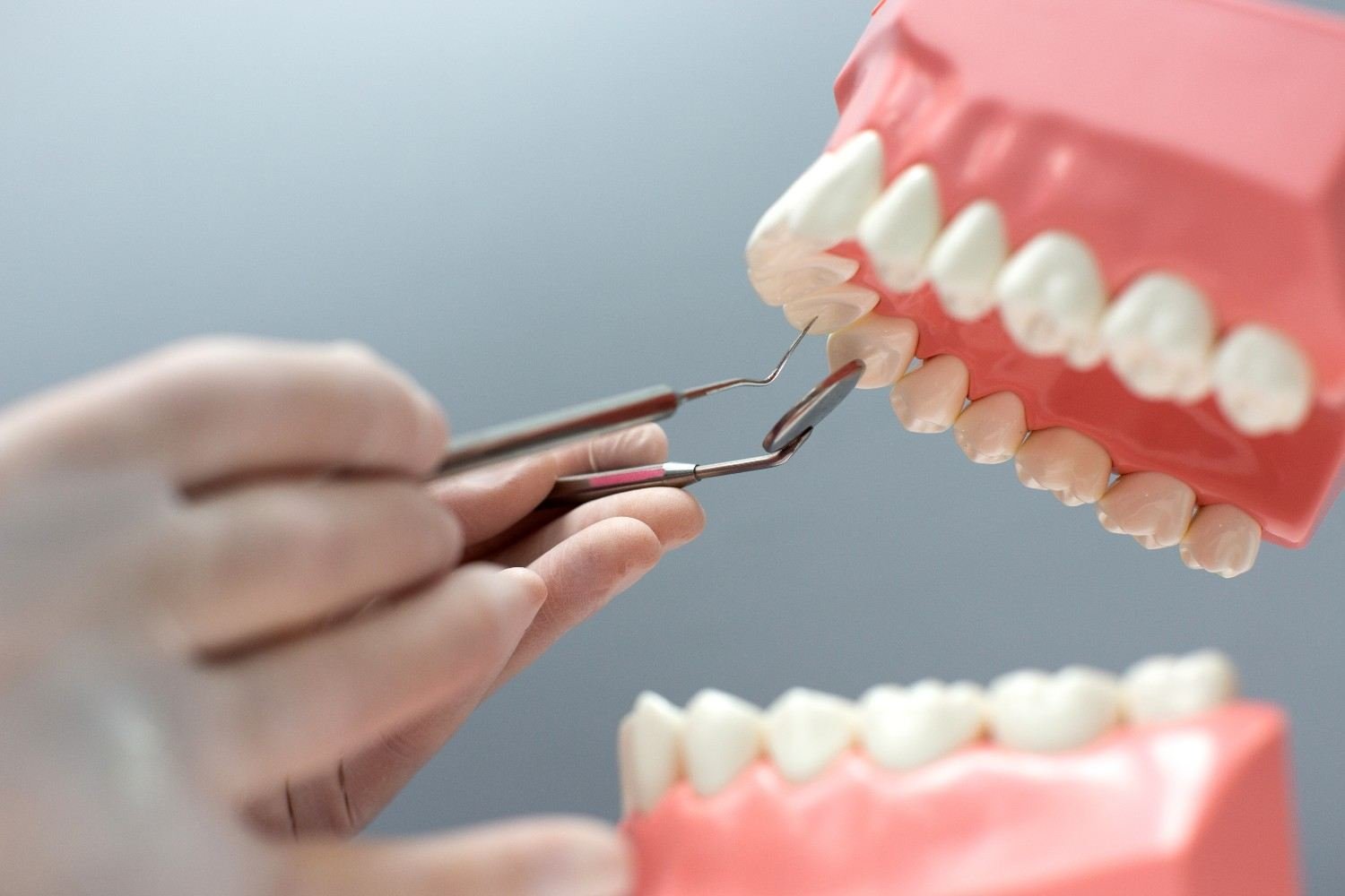 Dental Crowns and Bridges Clinic in Saket