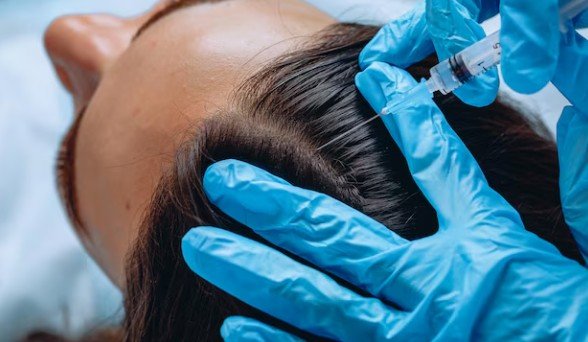 Hair Thinning Treatment in Saket