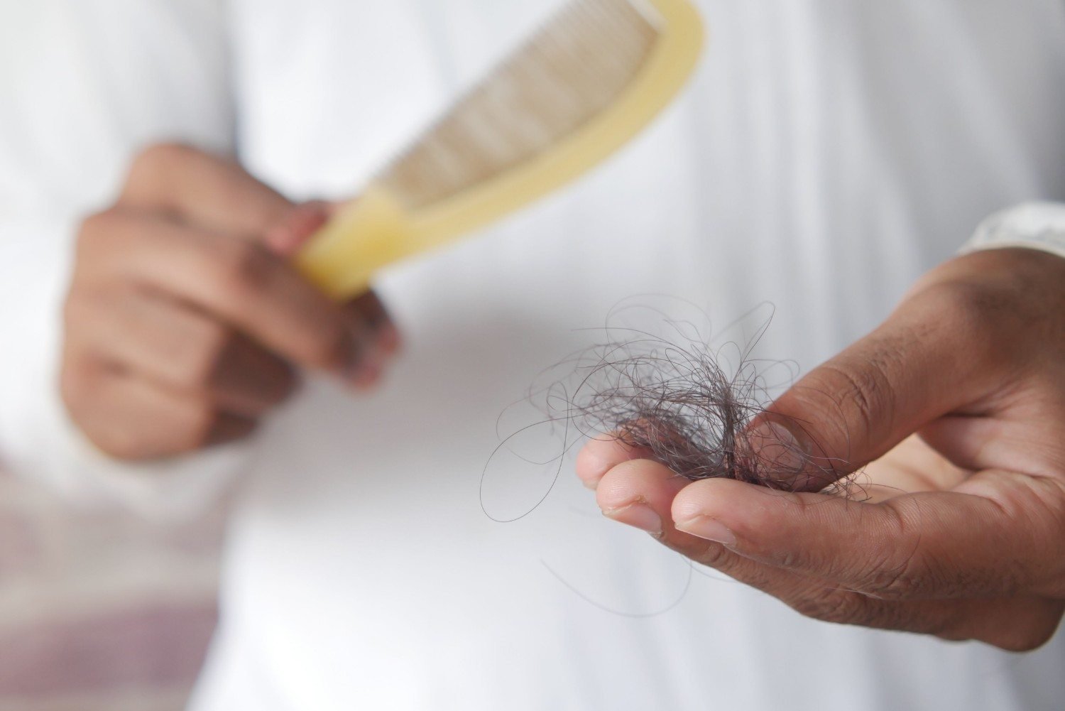 Hair Fall treatment Doctor in saket